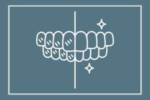 teeth whitening