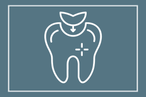 tooth fillings