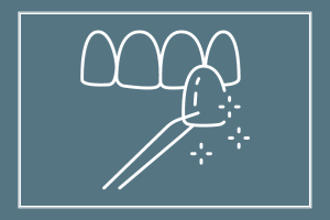 dental teeth veneers
